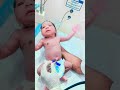 Newborn baby moro test #shorts #newborn #youyubeshort #nicu #test