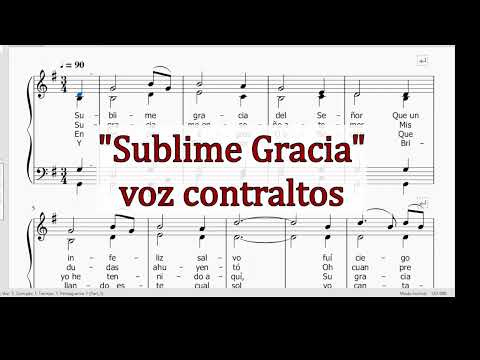 Sublime gracia -