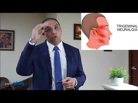 علاج الام العصب الخامس دكتور أحمد زهران