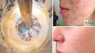 La Crema Famosísima Que Ha Limpiado Y Blanqueado Miles De Rostros | Mejor Salud