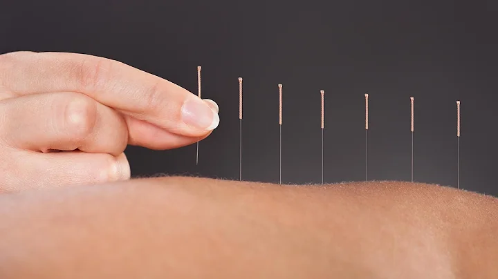 The Science Behind How Acupuncture Helps Relieve Pain: A Doctor Of Chinese Medicine Explains - DayDayNews