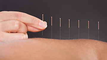 What do acupuncture needles go into?
