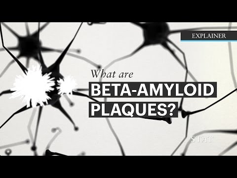 What are Beta-Amyloids plaques?