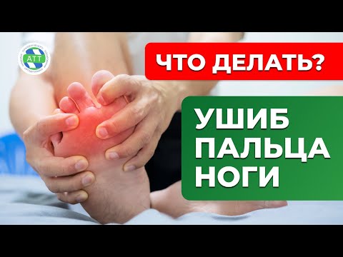 Видео: Как лечить ушибленный палец ноги: 14 шагов (с иллюстрациями)