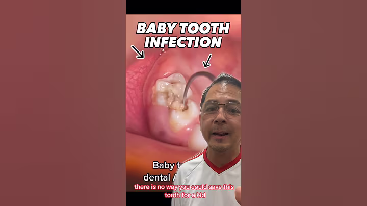 How to Treat an Abscess Baby Tooth | In Office to Hands On Dental Training #shorts