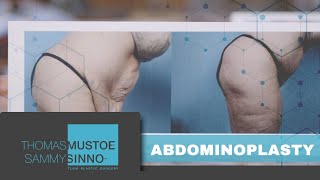 TLKM Plastic Surgery: Abdominoplasty