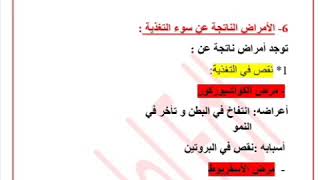 الأمراض الناتجة عن سوء التغذية للسنة الأولى متوسط بالنسبة لمادة العلوم الطبيعية