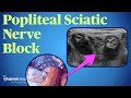 Popliteal Sciatic Nerve Block - YouTube