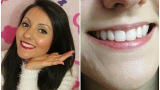 5 MODI per SBIANCARE i DENTI NATURALMENTE!!!! 5 HACKS FOR TEETH WHITENING | Le Ricette di Jennifer screenshot 2
