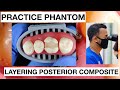 Practice class ii composite restoration  general dentist griya rr