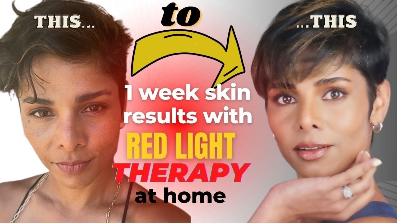 How to Improve Benefits of RED LIGHT THERAPY for Skin