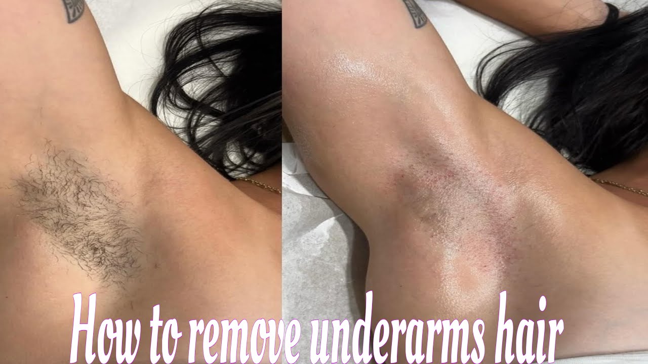My Armpit Routine for clear underarms | How to Remove underarms Hair 