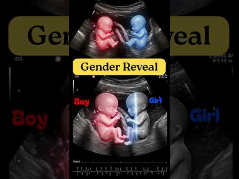Amazing Gender Reveal In Pregnancy Twins Ultrasound