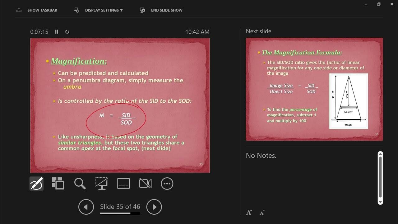 Radiography Lecture Image Distortion Magnification YouTube