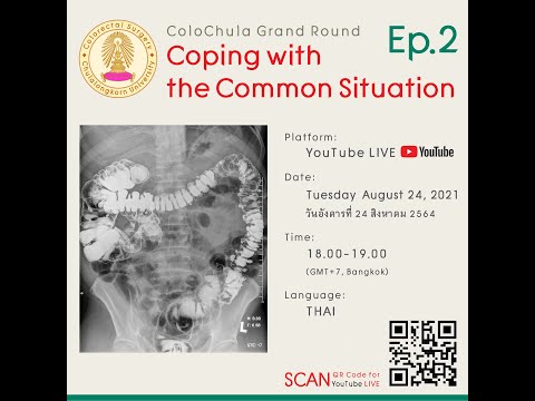 ColoChula Grand Round : Coping with the Common Situation Ep. 2 : Acute Diverticulitis