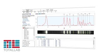 CLIQS 1D PRO | 1D Gel Image Analysis Software | TotalLab