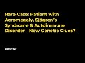 Rare Case: Patient with Acromegaly, Sjögren’s Syndrome & Autoimmune Disorder—New Genetic Clues?
