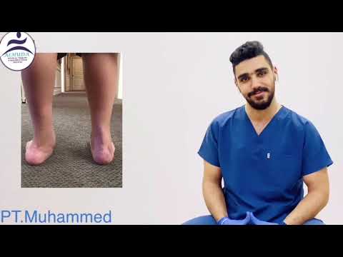    القدم المسطحه وعلاجها