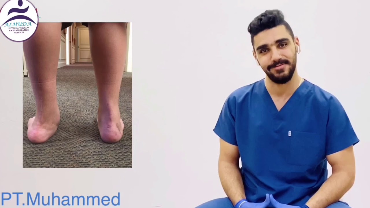 Flat feet treatment, القدم المسطحه وعلاجها