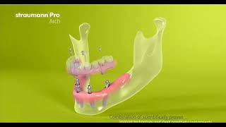 Straumann Pro Arch