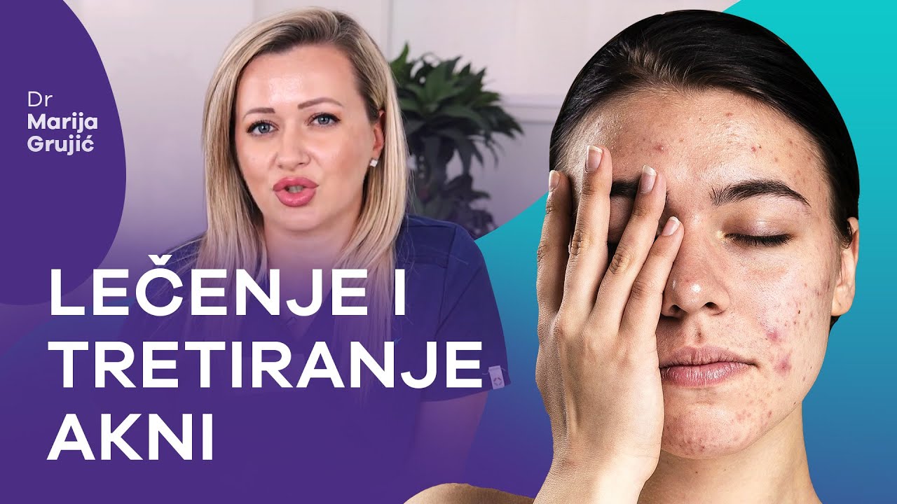 Da li se akne ( bubuljice ) mogu izlečiti?