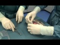 Kidney Assist Transport - instruction video: Connection with double artery patch