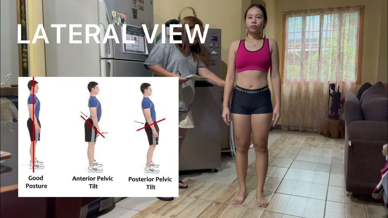 PED 026 MODULE 2 STATIC POSTURAL ASSESSMENT YouTube