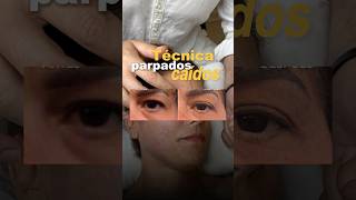 Video completo👇 #arrugas #masajes