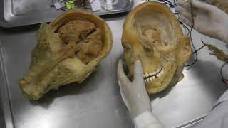 Snc Sistema Nervioso Central - Na Práctica - Parte 1