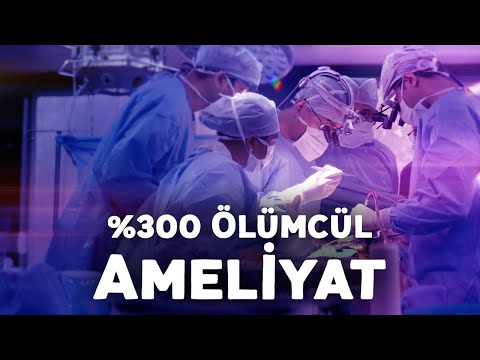 %300 Ölümcül Ameliyat!