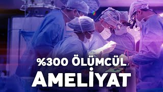 %300 Ölümcül Ameliyat! Resimi