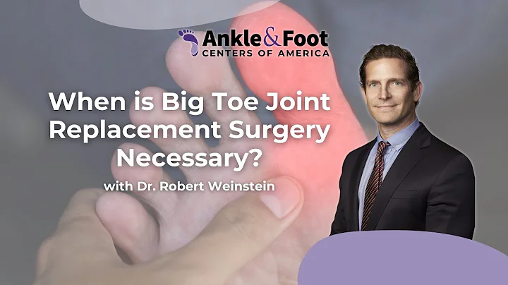 When is Big Toe Joint Replacement Surgery Necessary? | Ankle & Foot Centers of America