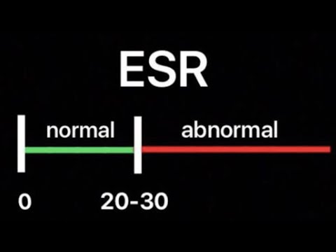 Video: Ano ang ESR Wintrobe test?