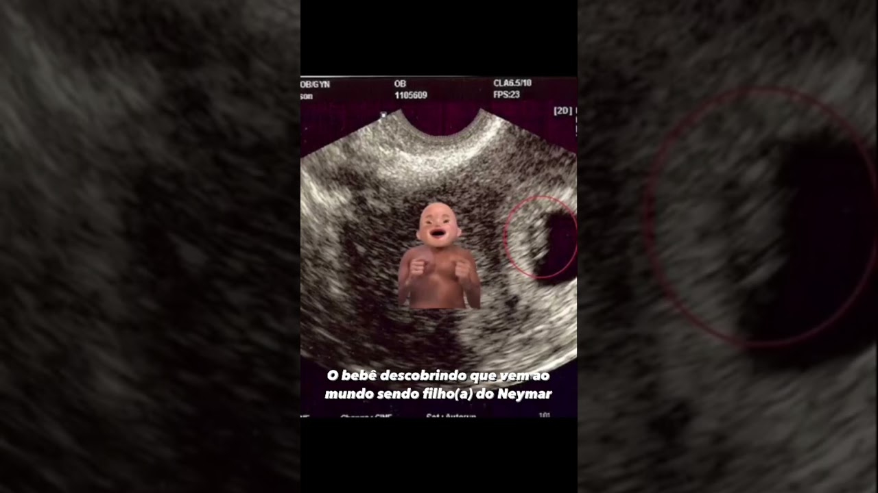 Neymar vai ser pai e olha o bebê como está !!!😆 #humor #alegria #piada #resenha #comédia #memes