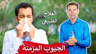 العلاجات الطبيعية لمشاكل الجيوب المزمنة