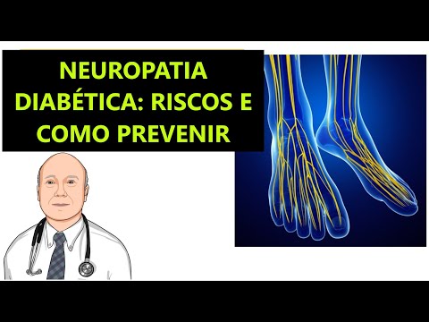 Vídeo: 3 maneiras de diagnosticar neuropatia