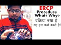 Ercp procedure video in Hindi