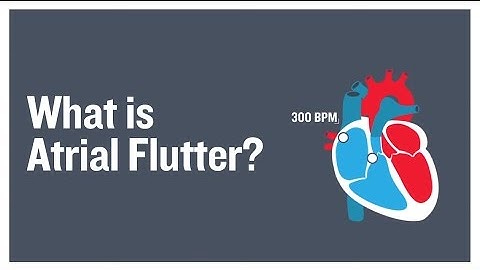 What is atrial flutter?