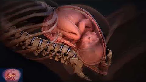 Early Water Breaks in Pregnancy |Amniotic Sack Breaks |