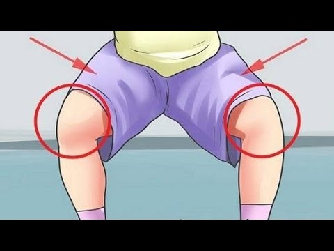 Video Lutut Nyeri Dan Lemas
