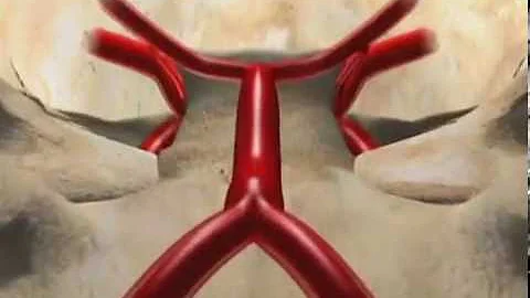 Como o sangue chega até o cérebro?