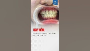 Niềng Răng: Mức độ Nguy hiểm của Khớp Cắn Đối Đỉnh | Khớp Cắn Đối Đầu | Niềng Răng Mắc Cài