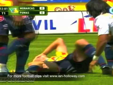 Mauricio Romero Snaps His Ankle Against Pumas