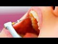 Clínica Dental Cuevas Queipo - "Dra Borrey - Endodoncia"