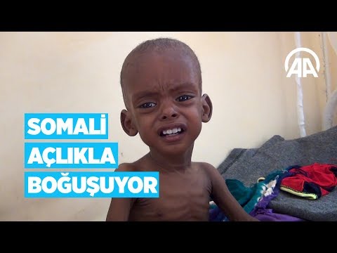 Somali açlıkla boğuşuyor