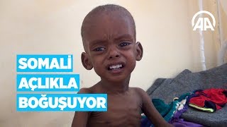 Somali açlıkla boğuşuyor Resimi