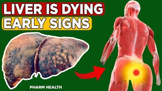 A Silent Warning: 6 Signs That Could Indicate Fatty Liver Disease