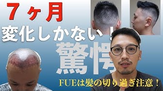 若はげ Youtube 若はげ Youtube