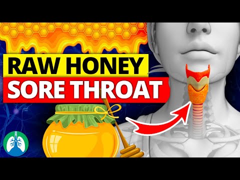 Videó: Segít a méz a torokfájáson?