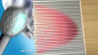 MI Paste™ and MI Paste Plus™ - Drs. Hopkins & Kane's Dental
